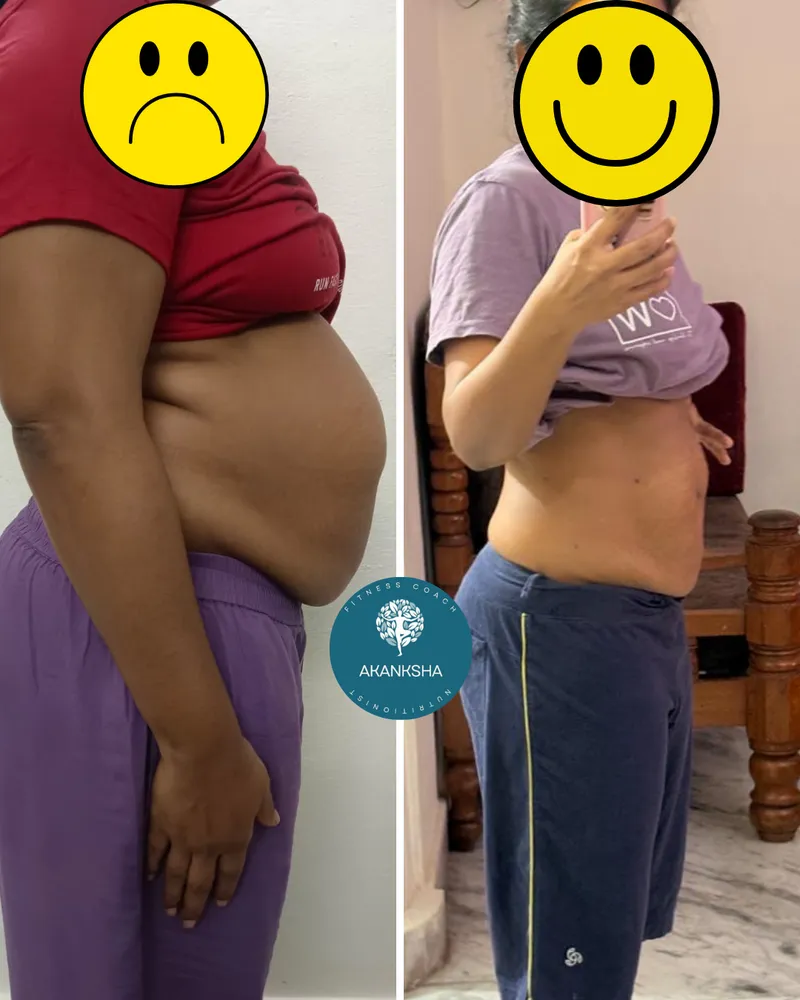 Side-profile before-and-after of a client's midsection after coaching with Akanksha (identity protected).