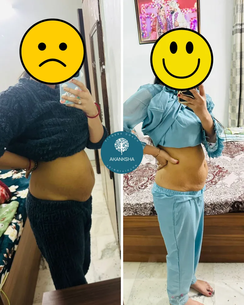 Side-profile before-and-after of a client's postpartum tummy after a recovery programme (identity protected).