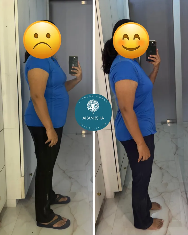 Side-profile before-and-after of a client's weight-loss transformation (identity protected).